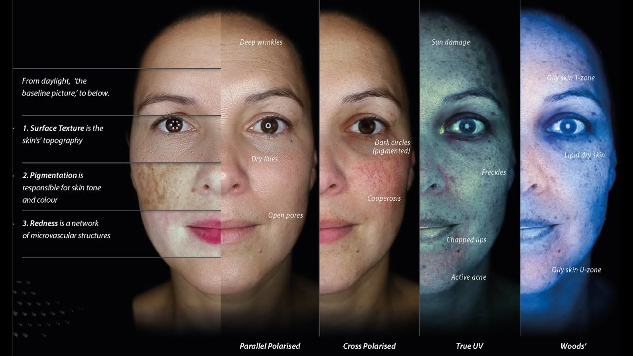 Luminary First Time Treatment With Consultation